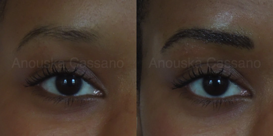 Permanent Eyebrows