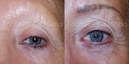 Permanent Eye Makeup