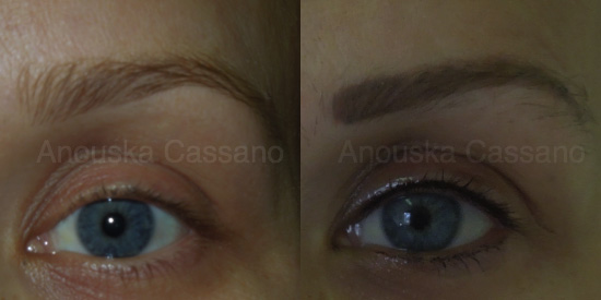 Before and After Eyebrow Correction